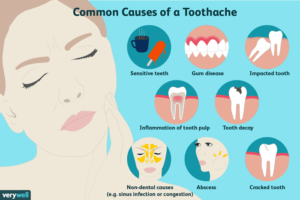 causes of toothache