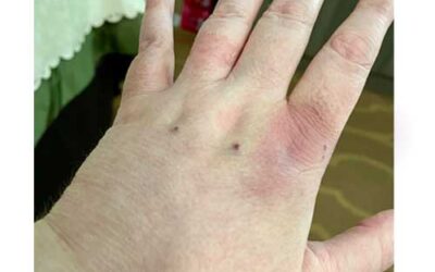 Today Was Extremely Painful