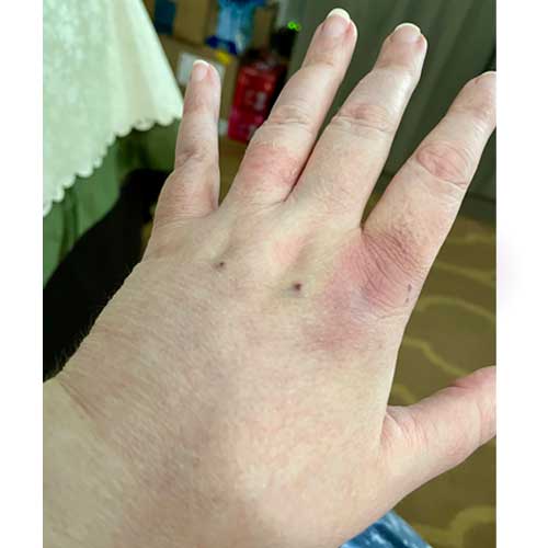 Today Was Extremely Painful