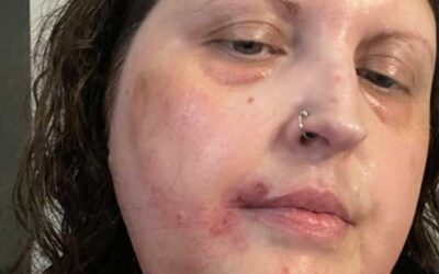 I Became Very Honest