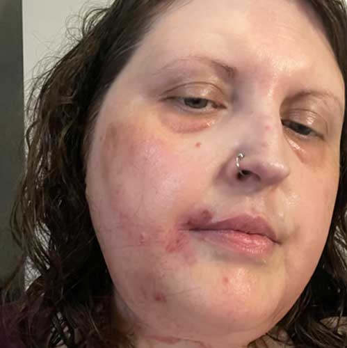 I Became Very Honest